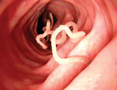 Anthelmintics